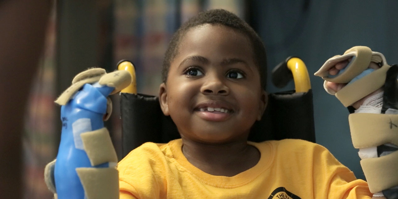 First child double hand transplant announced in U