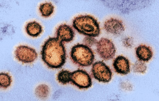 coronavirus
