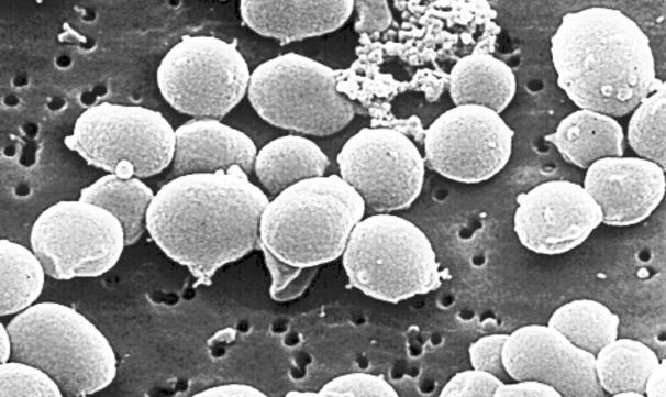 microbes-extremophiles_fig3_archee-hyperthermophile-abyssale