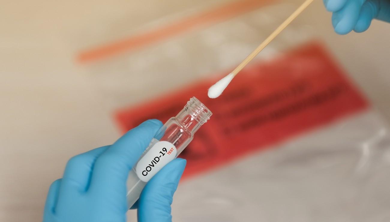tests covid pcr 3