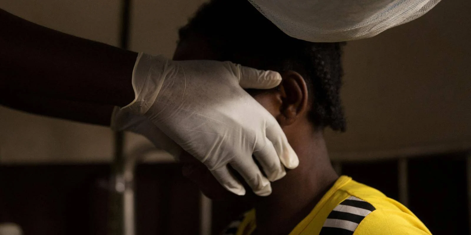 Mpox en Afrique: 53.903 cas enregistrés dont 11.147 confirmés et 1.109 décès