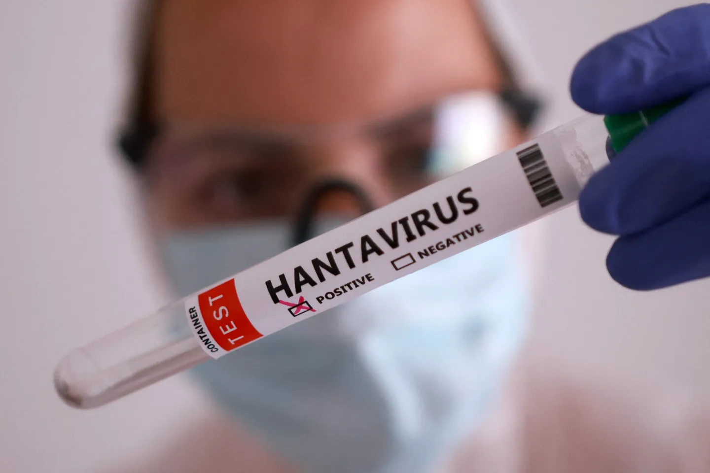 Hantavirus