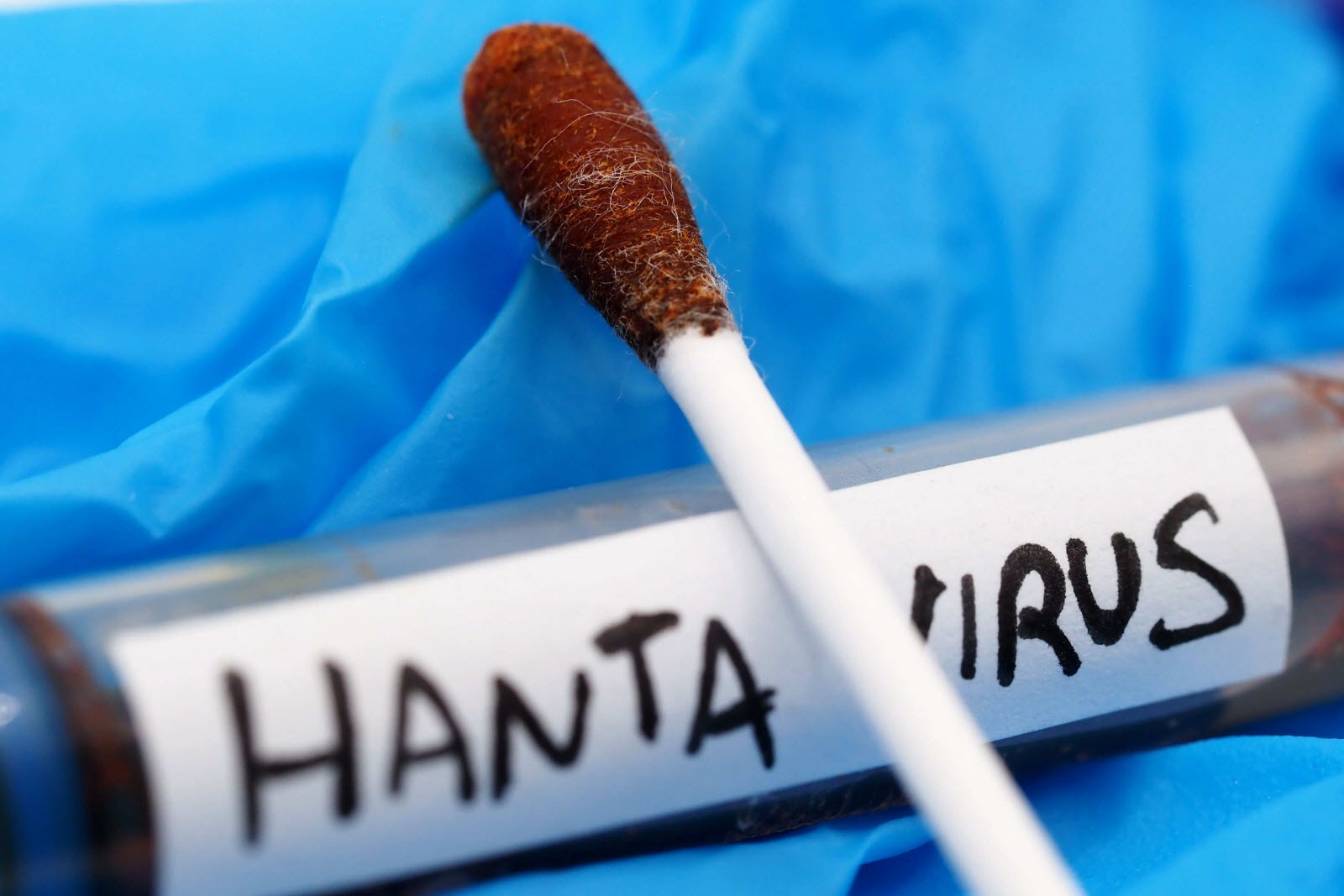 Hantavirus